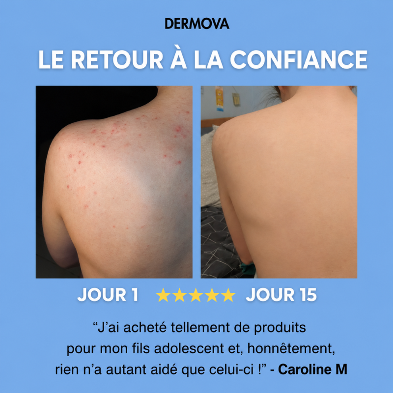 LE DERMOVA BAR™