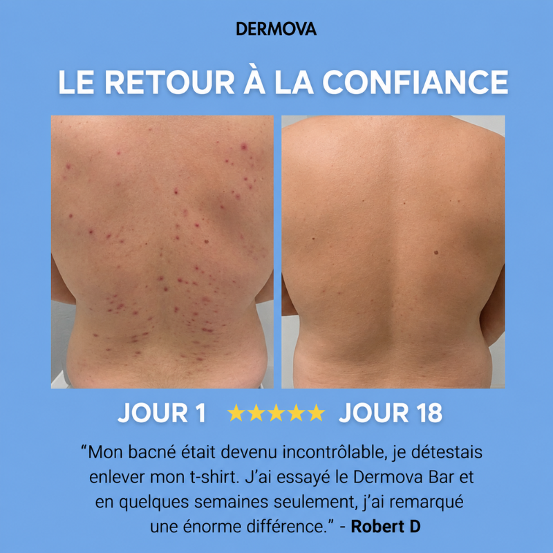 LE DERMOVA BAR™