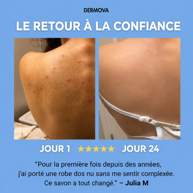 LE DERMOVA BAR™